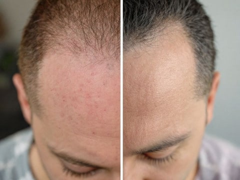 علاجات سريعة لصحة فروة الرأس