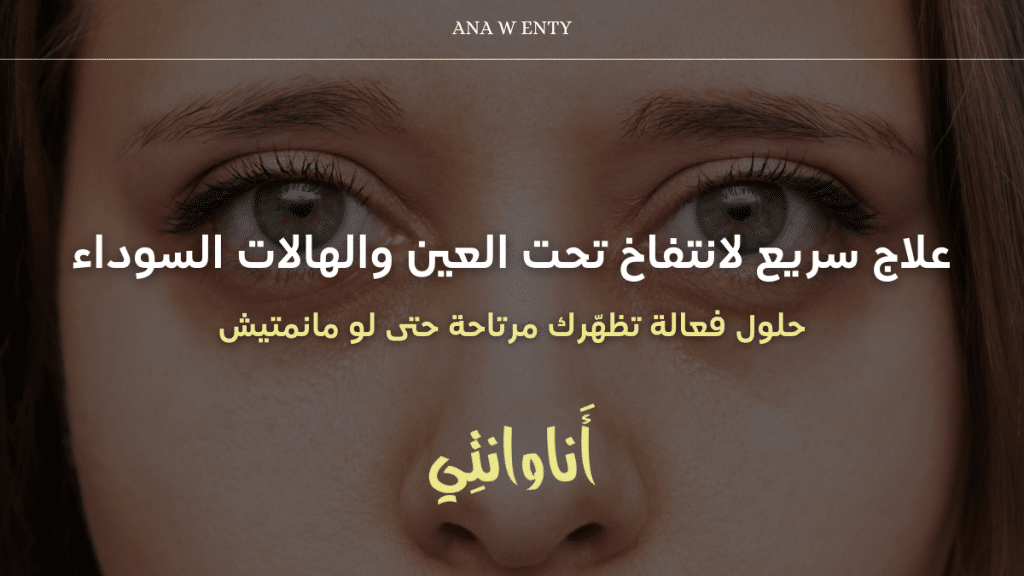 علاج سريع لانتفاخ تحت العين والهالات السوداء – حلول فعالة تظهّرك مرتاحة حتى لو مانمتيش!