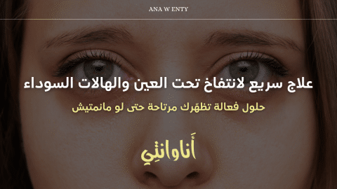 علاج سريع لانتفاخ تحت العين والهالات السوداء – حلول فعالة تظهّرك مرتاحة حتى لو مانمتيش!